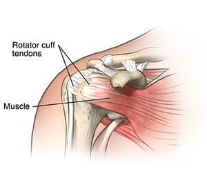 rotator cuff