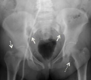 Pelvis and Hips / SI Joint Target Series